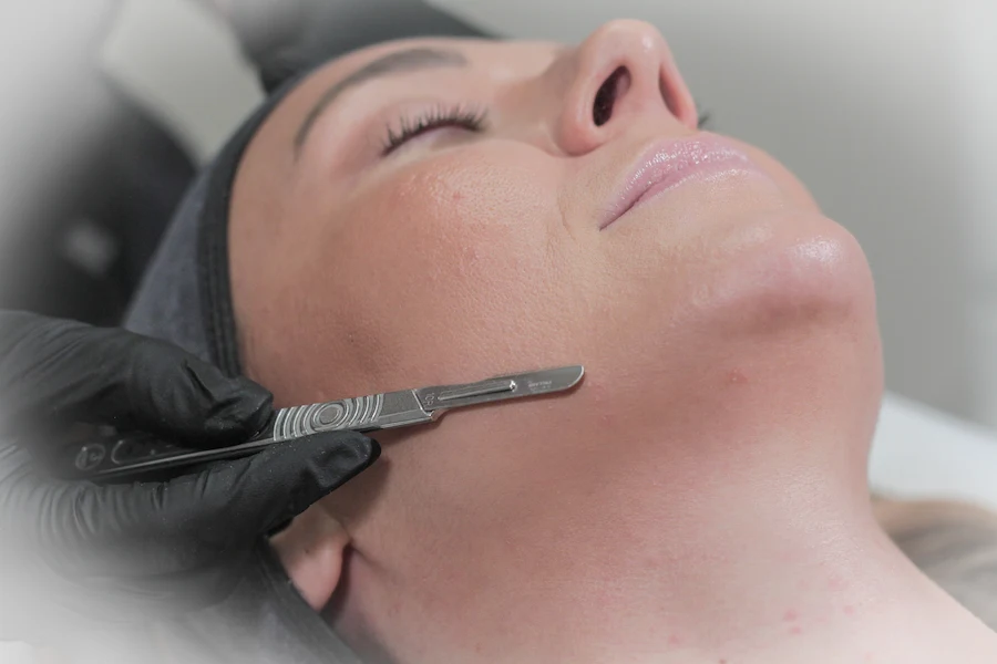 Dermaplaning-Treatment-at-You-Glow-Aesthetics