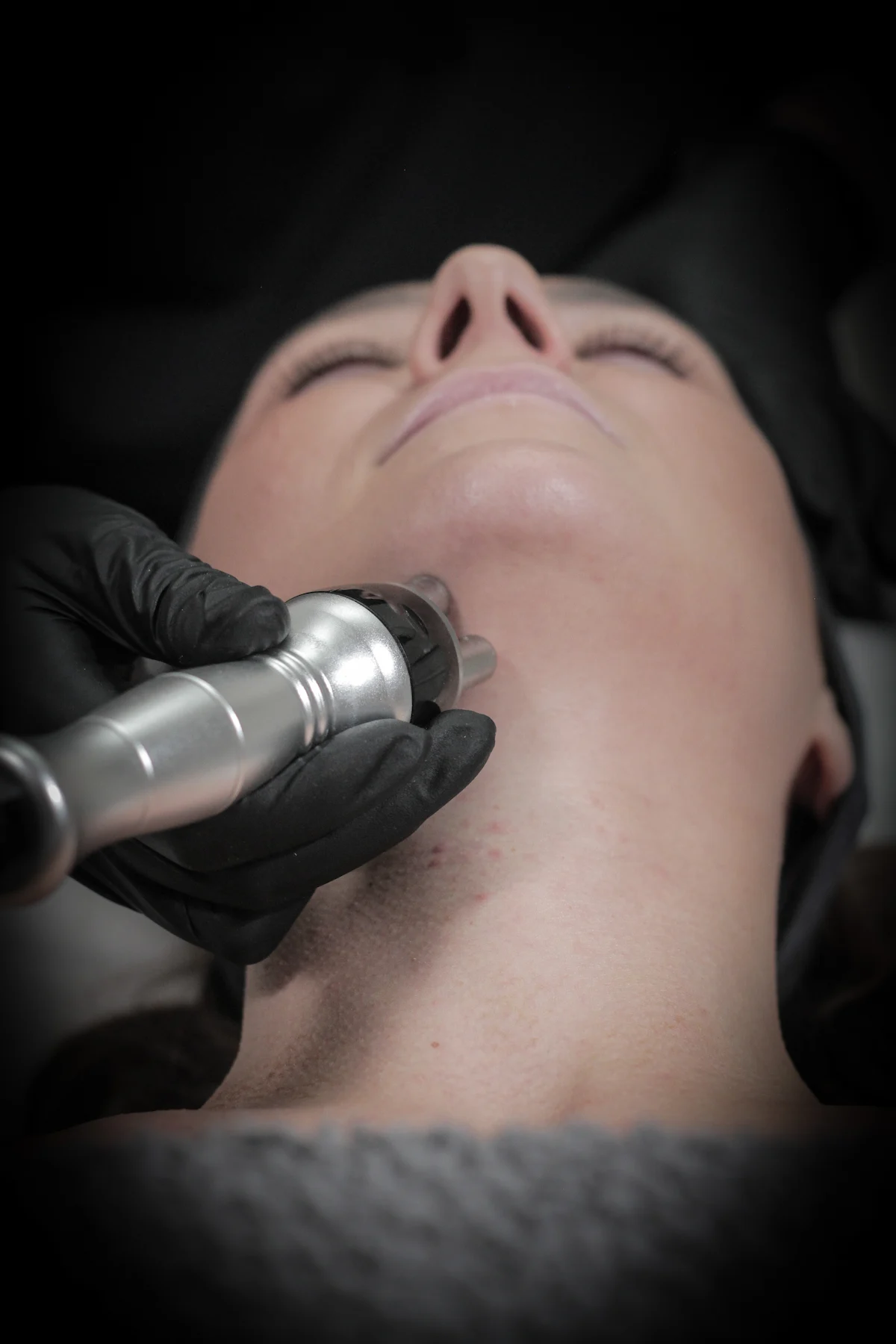 Radio-Frequency-Skin-Tightening-Treatment